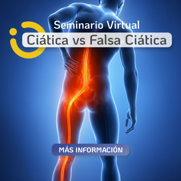 Ciática vs Falsa Ciática
